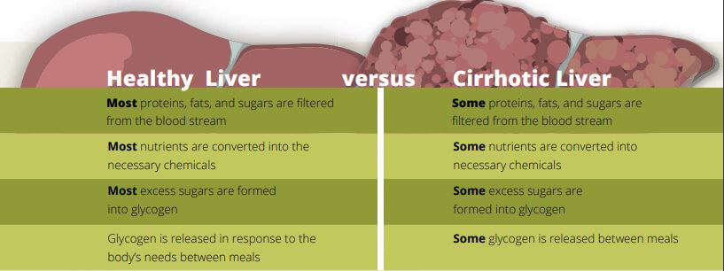 A two column chart listing the differences between the functions of a healthy liver versus a cirrhotic liver. The background shows a smooth, burgundy liver on the left, and a scarred somewhat black liver on the right. 