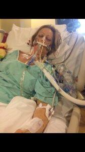 A woman with tubes at the hospital during a liver transplant