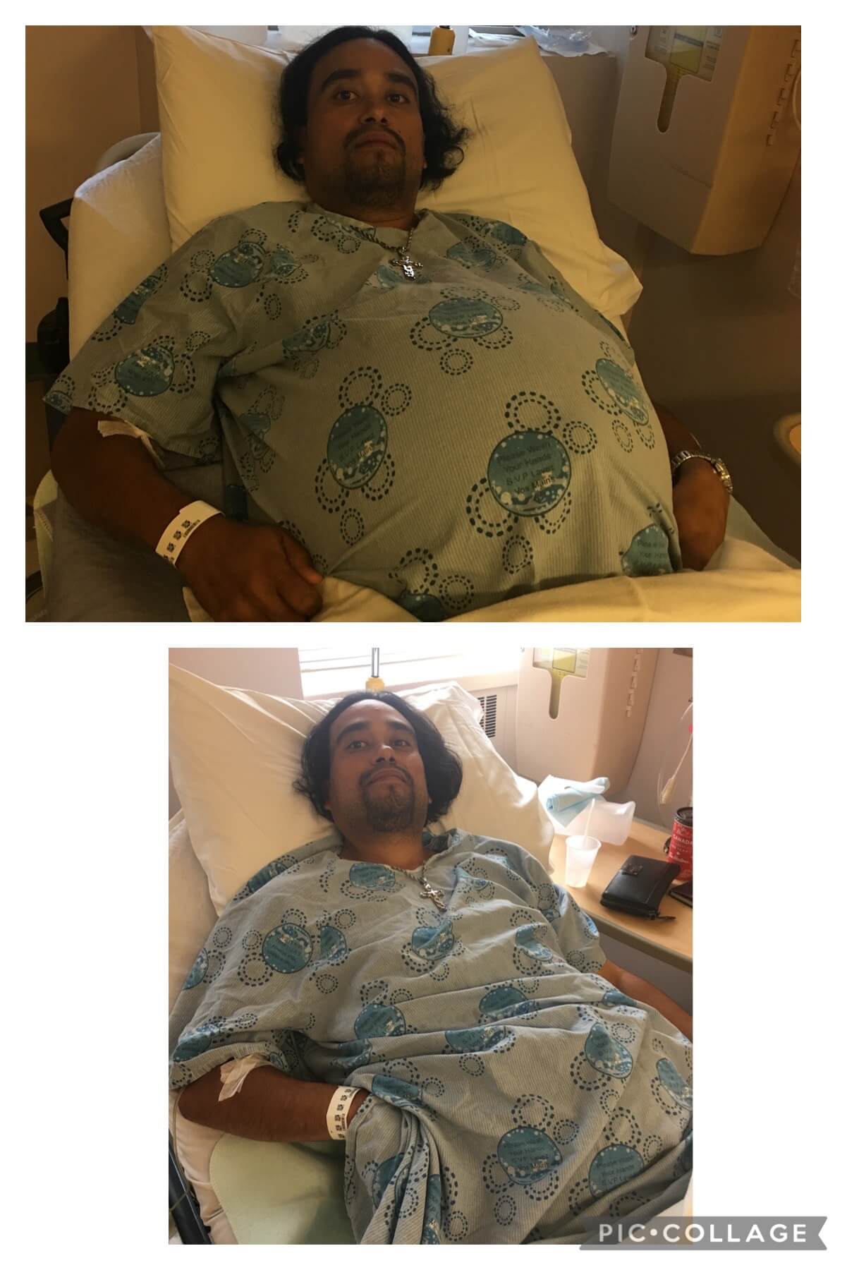 Gonzalo in hospital with swollen abdomen