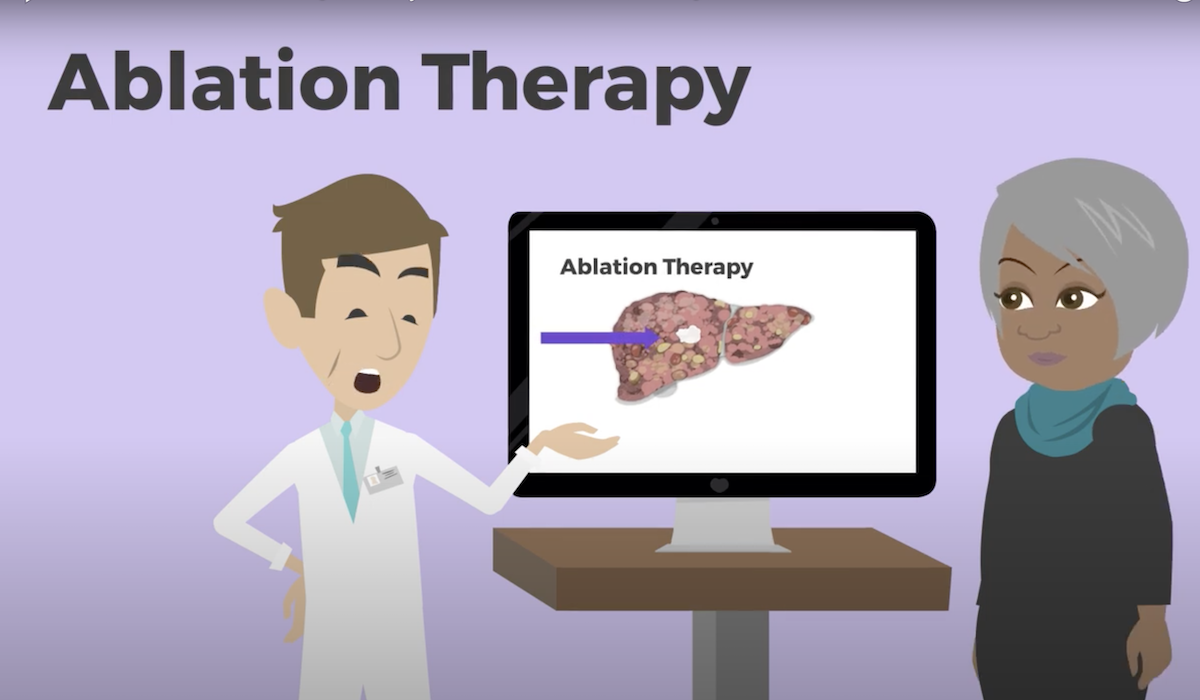 Ablation for Liver Cancer Canadian Liver Foundation